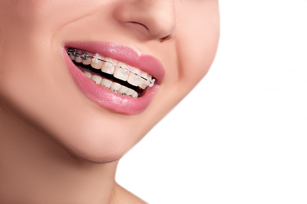 woman with braces smiling
