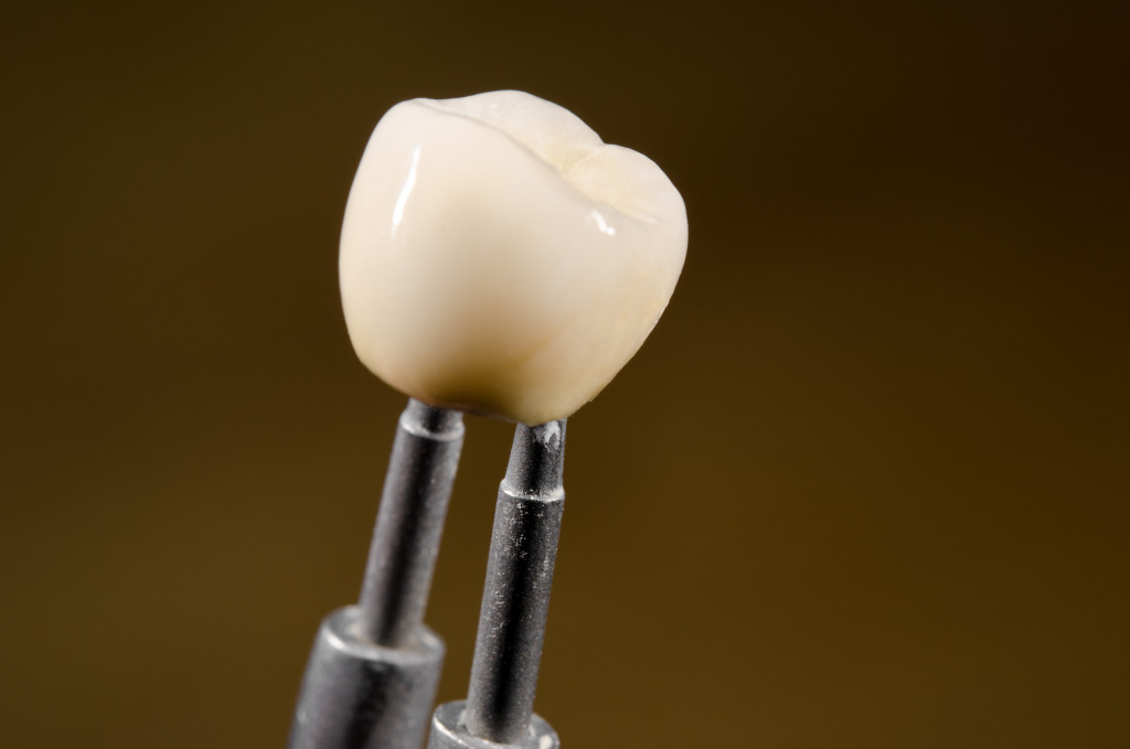 3D-printed tooth implant